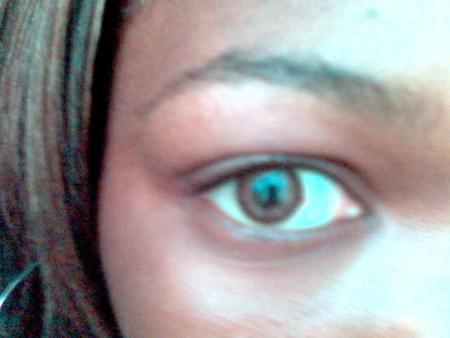 My eye